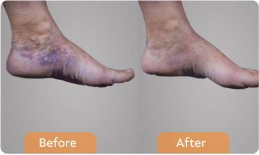Our patient stories