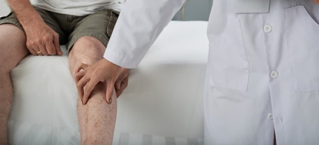 Spotting The Symptoms And Signs Of Peripheral Arterial Disease