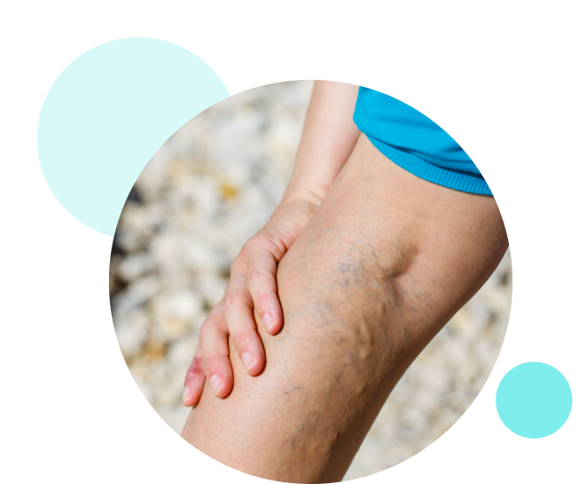 sclerotherapy doctor