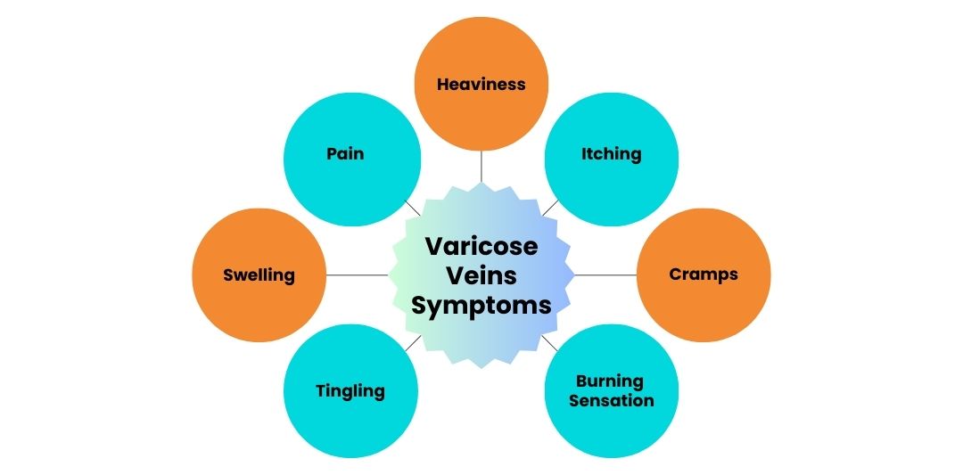 Common Varicose Veins Symptoms