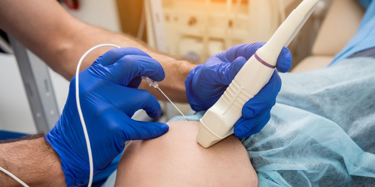 Radiofrequency ablation cost