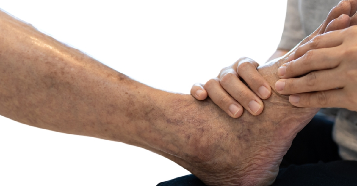 Reverse peripheral artery disease