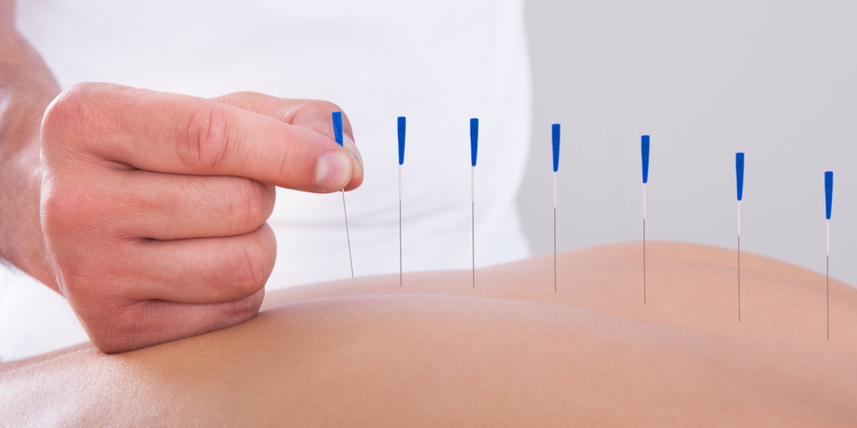Pain Management Techniques - Acupuncture