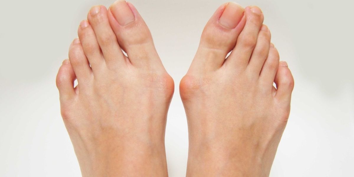 Best podiatrist for bunions