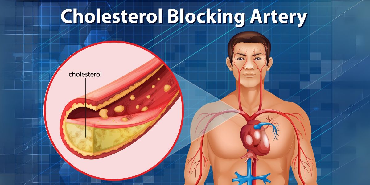 how does stress affect your arteries