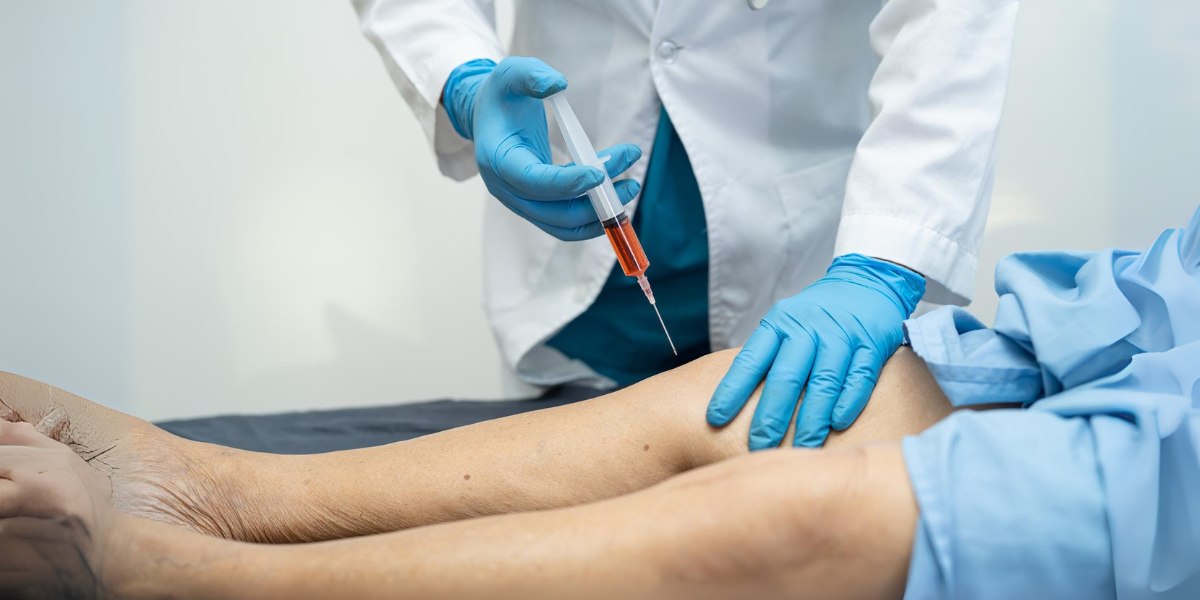 Benefits Of Genicular Artery Embolization