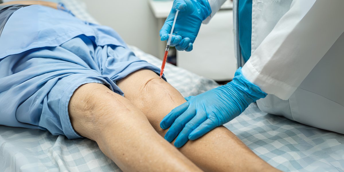  how long until sclerotherapy shows results