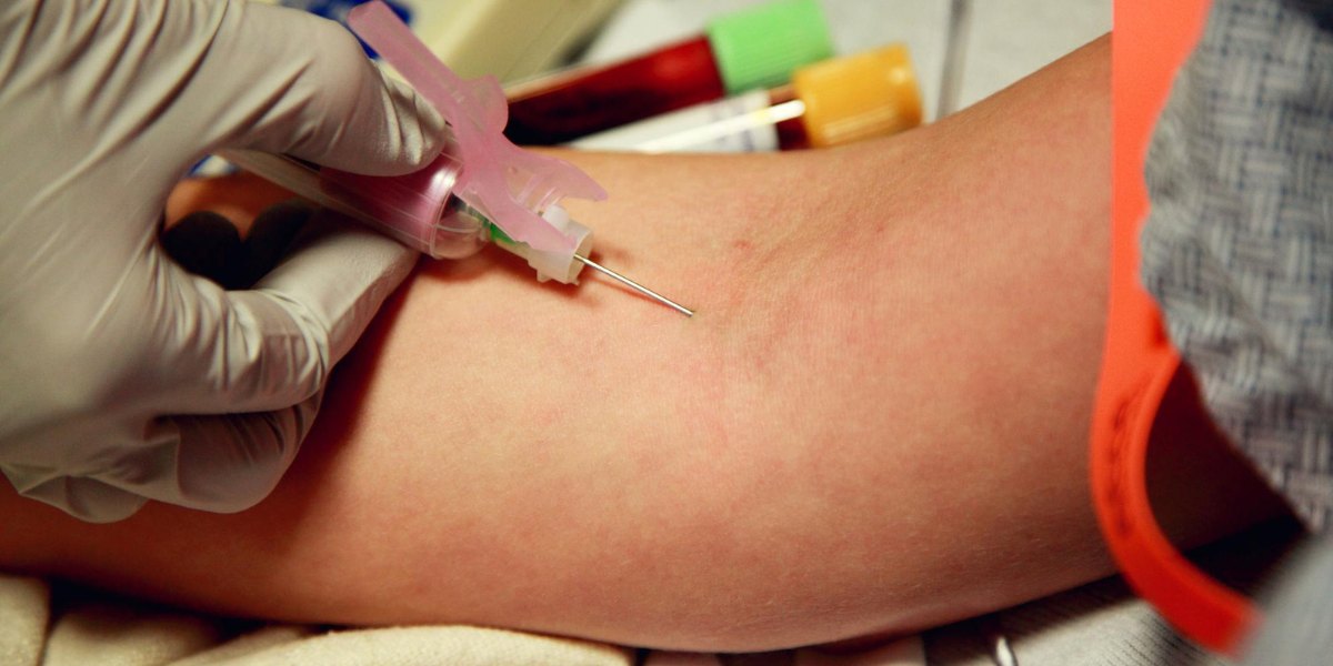 what test is done for peripheral artery disease