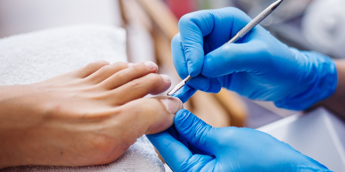 what do podiatrists use to soften toenails