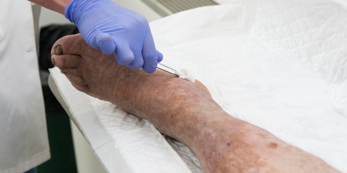 Which doctor treats venous insufficiency