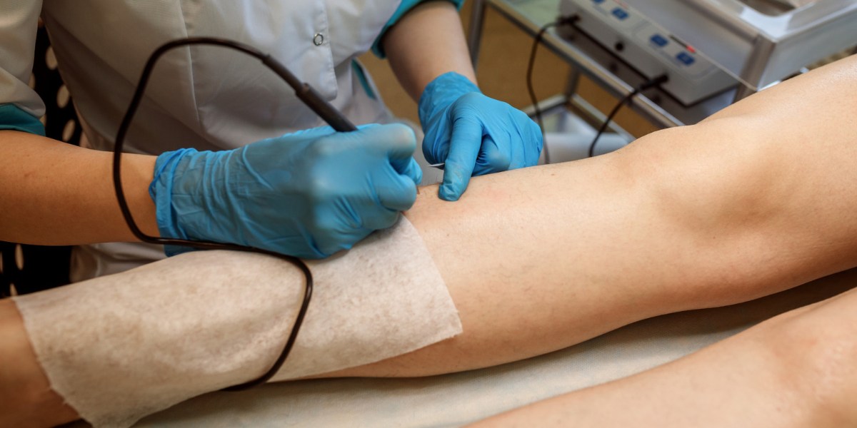 how much does laser ablation cost