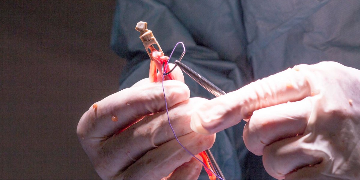 is genicular artery embolization safe