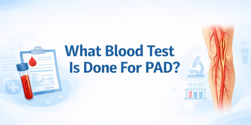 What Blood Test Is Done For PAD?